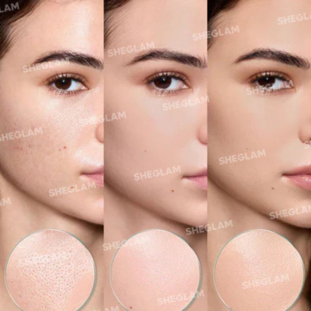 Before and After Using SHEGLAM Pore No More Primer