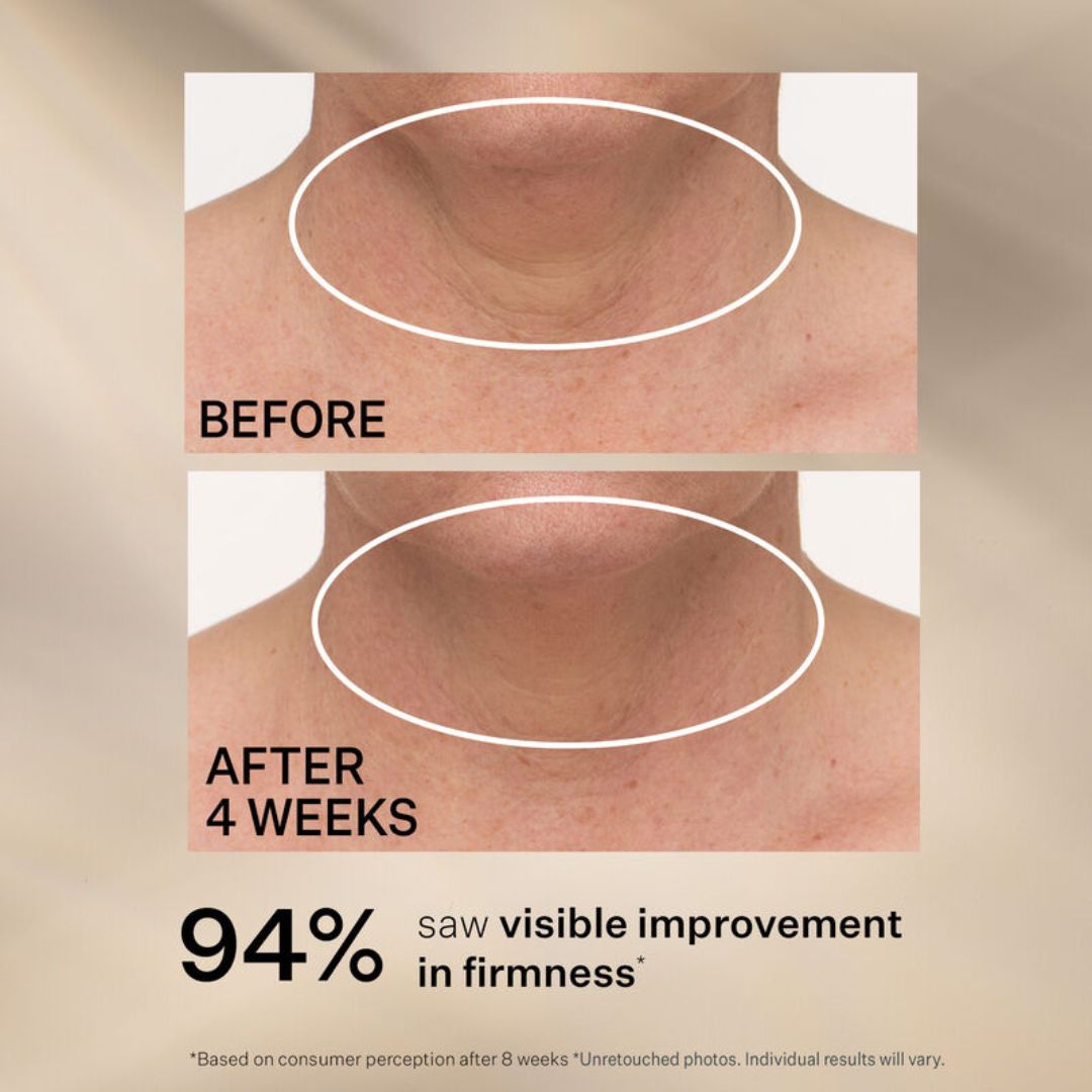 StriVectin TL Advanced Neck Cream texture close-up