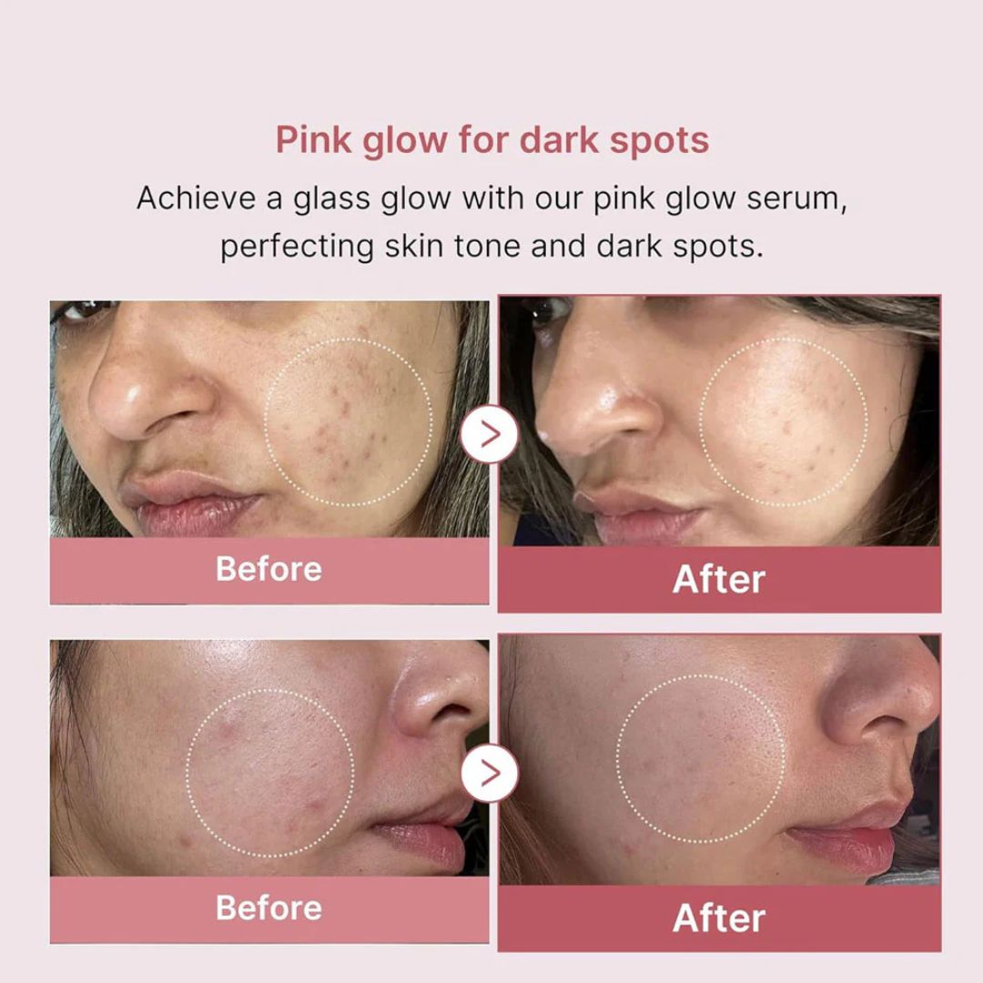"Close-up of Medicube PDRN Pink Peptide Serum’s lightweight, slightly pink-tinted gel texture on skin."

